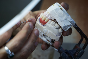 Dental technician working with articulator in dental laboratory, close-up. Dentist hands holds prosthesis on a plaster jaw his lab