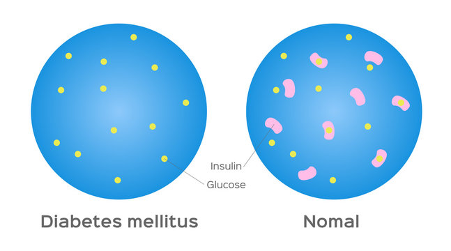 Glucagon Bilder Durchsuchen 1,202 Archivfotos, und