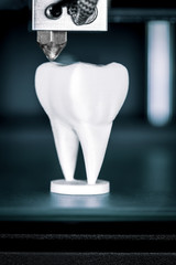 Verwendung eines 3D Druckers in der Zahntechnik oder Zahnmedizin, Zahnprothese wird durch fused...