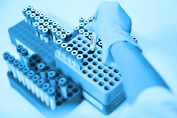 a glass test tube or a flask with blood in the hands of a scientist on the background of a laboratory