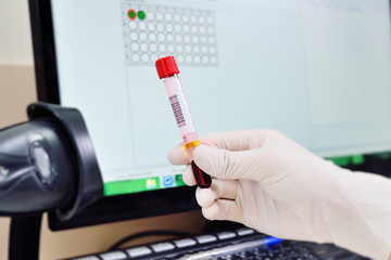 scanning bar code of test tubes in a bacteriological laboratory