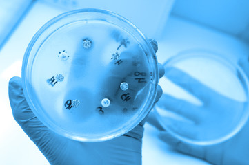 Petri dishes in the bacteriological laboratory