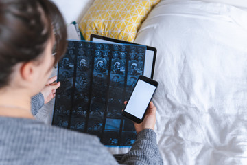 woman looking of magnetic resonance imaging result and holding phone with white screen