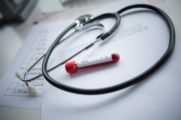 Close up of stethoscope and HIV test.