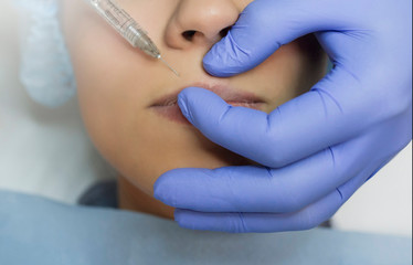 Top view of lips augmentation procedure on a young woman done by a cosmetologist doctor with Hyaluronic acid Injection.