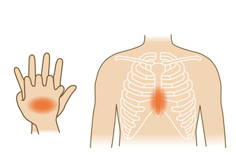 応急手当イラスト74：救急蘇生法・胸骨圧迫
