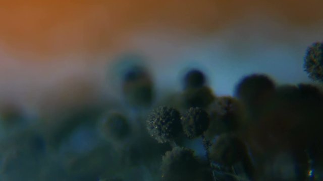 Black Mold taken from rotten bread , under a microscope. Colony of mold with spores on a bread crust. Allergy, poisoning, fungus. Abstract texture of a white mold colony. Close up. Closeup.4K UHD