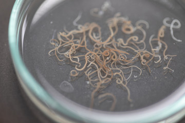 Ascariasis is a disease caused by the parasitic roundworm Ascaris lumbricoides for education in laboratories.