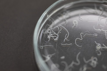 Ascariasis is a disease caused by the parasitic roundworm Ascaris lumbricoides for education in laboratories.