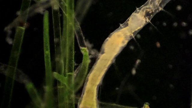 The microscopic segmented annelid, Stylaria.