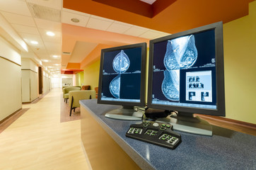 Mammogram images of breasts of a female patient. Screening possible cancer illness in female breasts