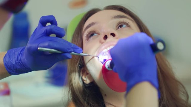 Dentist patient at tooth whitening procedure. Close up of dentist using dental curing light. Woman patient face with open mouth in dentist chair. Professional teeth restoration in dental clinic