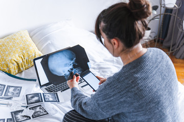 woman holding x-ray of head with phone in hand. laptop with white screen. medical results on background