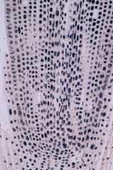 Root tip of Onion and Mitosis cell in the Root tip of Onion under a microscope.