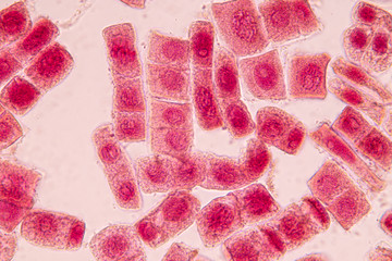 Root tip of Onion and Mitosis cell in the Root tip of Onion under a microscope.