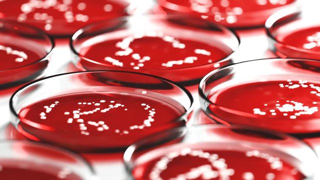 Petri dishes with red blood agar containing colonies of Staphylococcus aureus