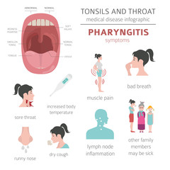 Tonsils and throat diseases. Pharyngitis symptoms, treatment icon set. Medical infographic design