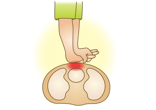 応急手当イラスト 救急蘇生法 胸骨圧迫 Stock Vector Adobe Stock