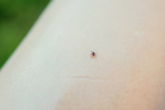 Tick crawling on the skin. The concept of danger of encephalitis and tick bite.
