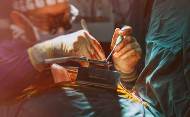 Heart surgery during open-heart surgery in operating room