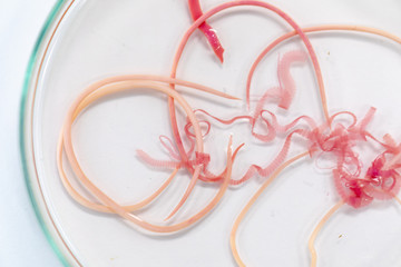Ascariasis is a disease caused by the parasitic roundworm Ascaris lumbricoides for education in...