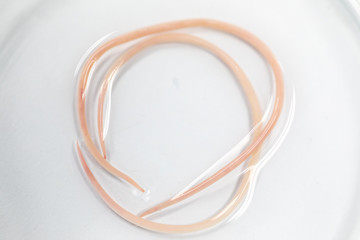 Ascariasis is a disease caused by the parasitic roundworm Ascaris lumbricoides for education in...