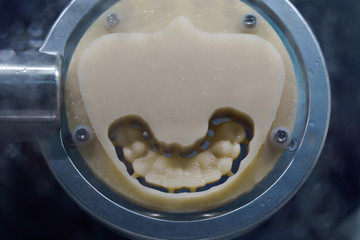 Dental milling equipment, cutting out temporary plastic from a special form, Modern dental technology