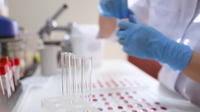 medical laboratory worker holds cuvette for definition of blood type and Rh factor.