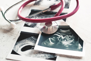In the pictures of the ultrasound 4 weeks of pregnancy and 20 weeks is a phonendoscope. The concept of the study of pregnancy. Observation Selective focus. - obrazy, fototapety, plakaty