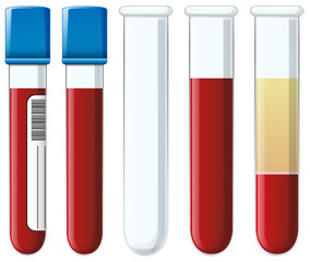 Set of blood collection tubes