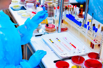 Petri dish. Microbiological laboratory. Mold and fungal cultures. Bacterial research