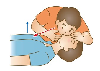 応急手当イラスト87：救急蘇生法・人工呼吸