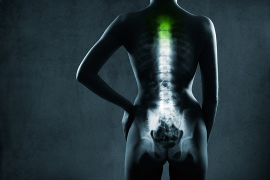 Human spine in x-ray, on gray background. The neck spine is highlighted by green colour.