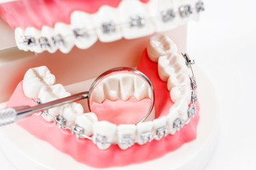 tooth model with metal wire dental braces and mirror dental equipment.