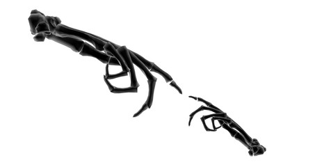 tow x-ray forearm connecting fingers to eachother in white background