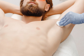 Male depilation laser hair removal procedure treatment.