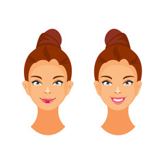 Otoplasty vector illustration