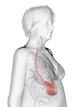 3d rendered medically accurate illustration of an obese womans stomach