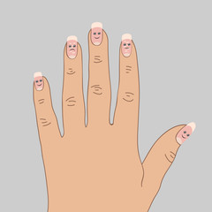 White spots on the nails. Cartoon illustration