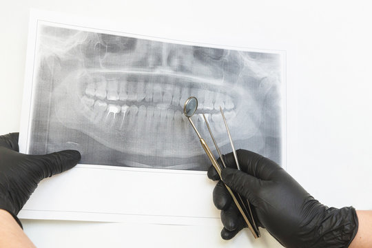 Dental clinic. Reception, examination of the patient. Teeth care. Dentist looks x-ray picture of a patient's jaw