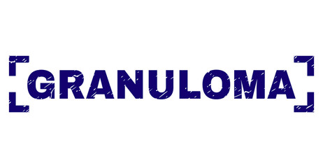 GRANULOMA text seal stamp with grunge texture. Text label is placed inside corners. Blue vector rubber print of GRANULOMA with grunge texture.