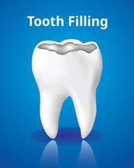 Tooth Filling, Dental care concept, Realistic design illustration Vector.