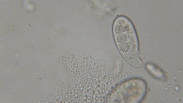 Motion of single-celled animals (infusoria) under microscope. Colony of ciliates Stylonychia under the microscope in lake water. Close up. UHD 4K