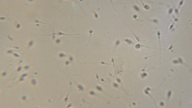 Sperm (spermatozoa) viewed under the microscope. Moving human sperm under Phase contrast Microscope. Close up showing spermatozoons. Video semen under microscope. 4K UHD