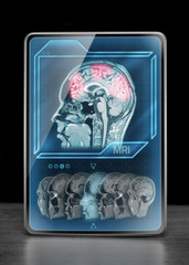 Modern tablet displaying brain activity 