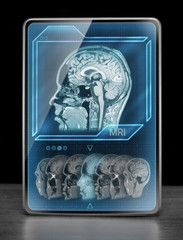 Medical tablet on table displaying brain scan