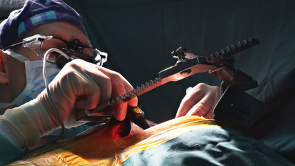 Surgeons working with a scissors on a patient in a heart surgeon open operating theater