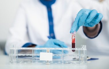 Professional facility investigations in healthcare system. Close up portrait of female laboratory worker putting test tube with blood into medicine board