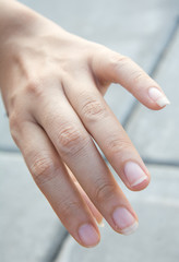 Image of a broken nail hand