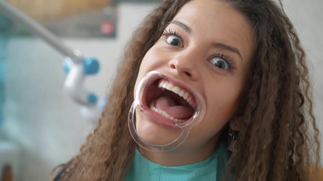 Professional cosmetic teeth whitening.